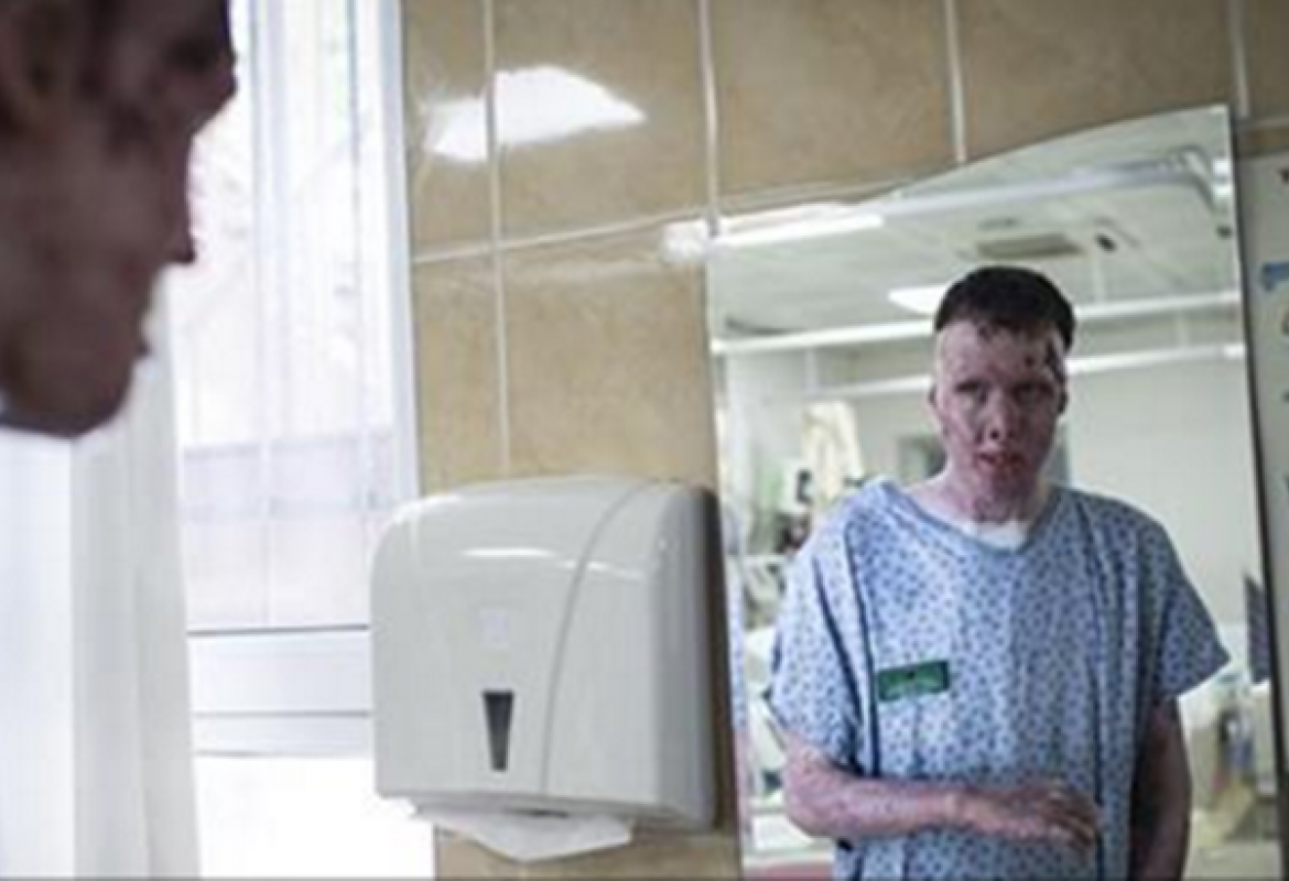 Aldin Jacić se uspješno oporavlja i iščekuje povratak kući