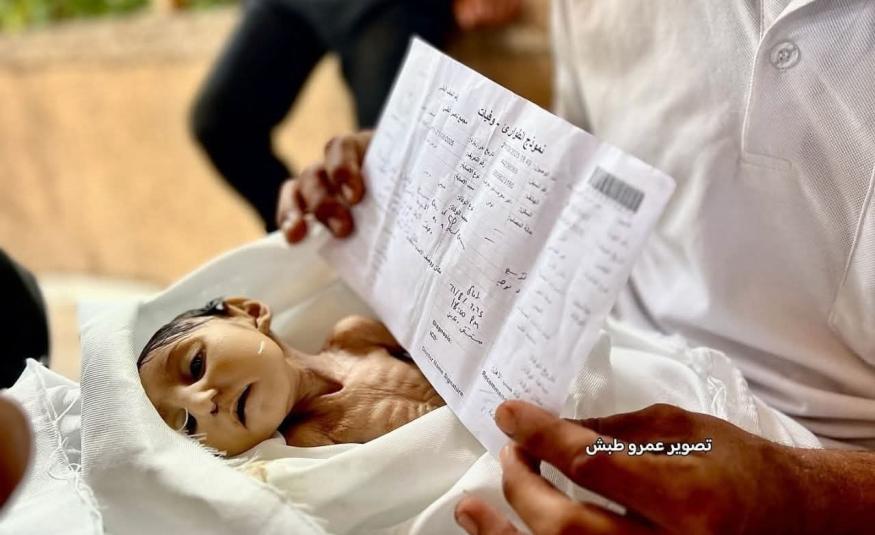 upravo umro od gladi gaza.jpg