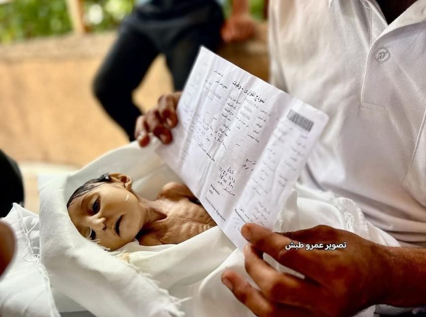 upravo umro od gladi gaza.jpg